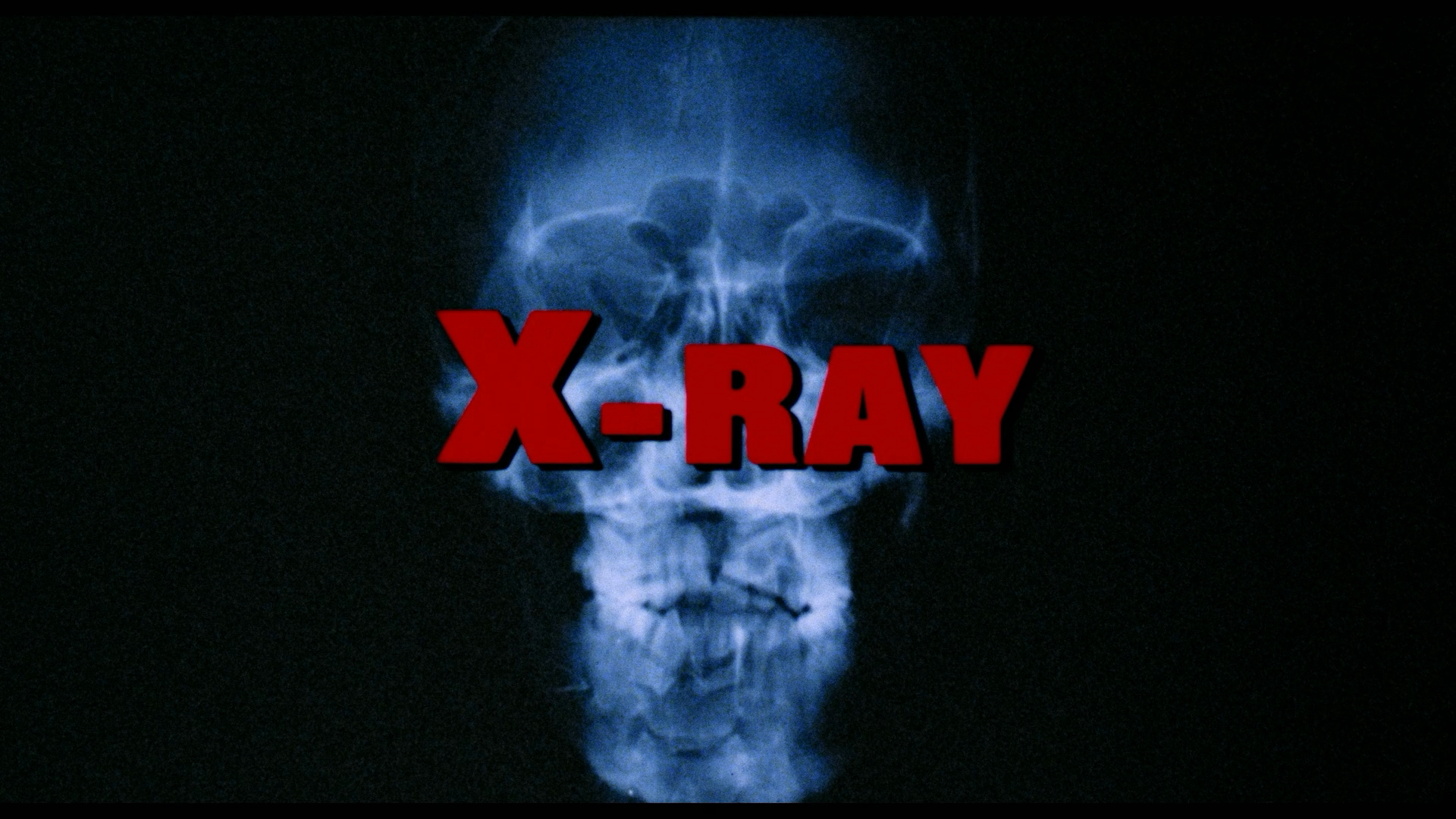 X-ray Blu-ray cap 1