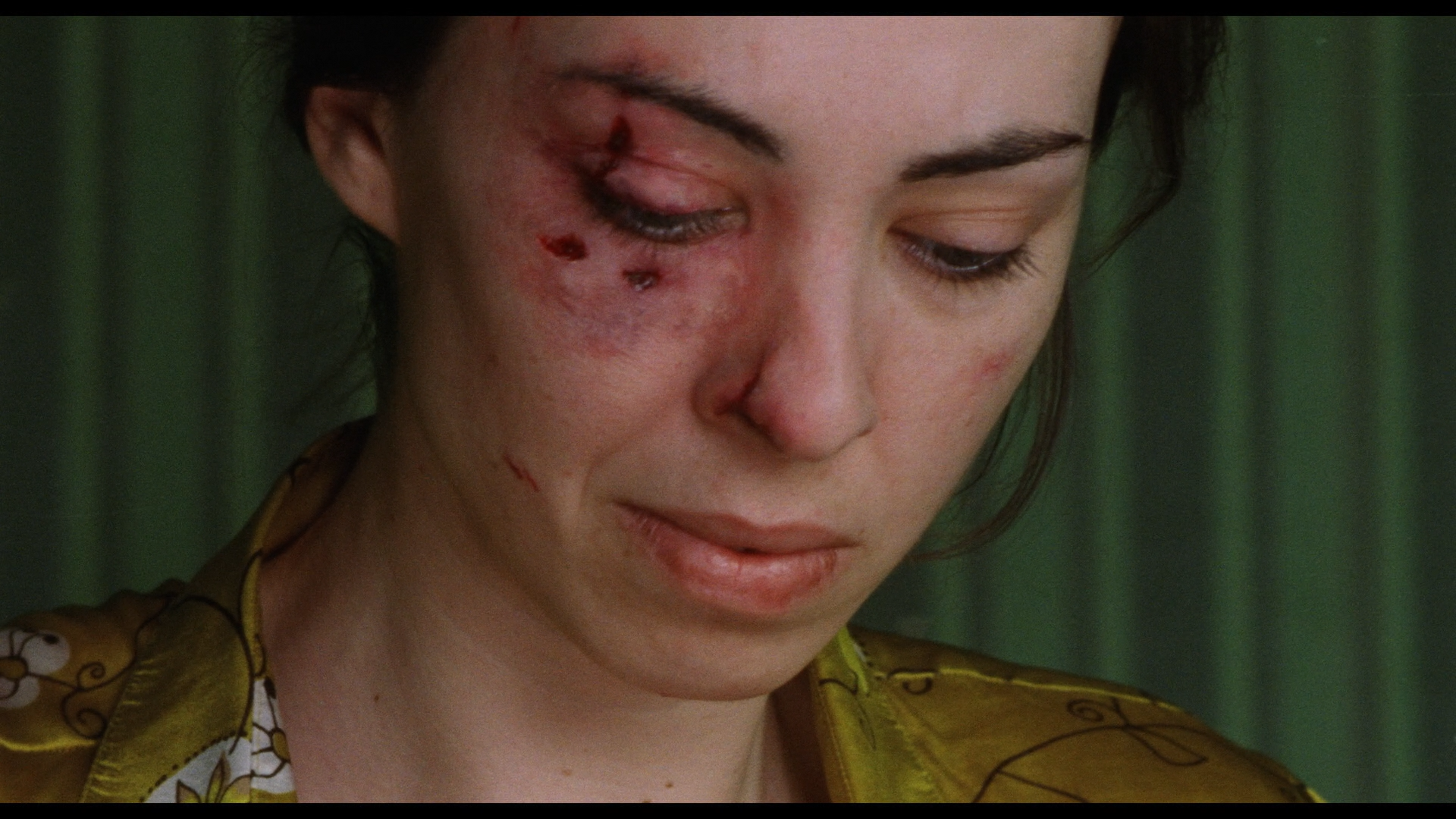 In My Skin Blu-ray cap 6