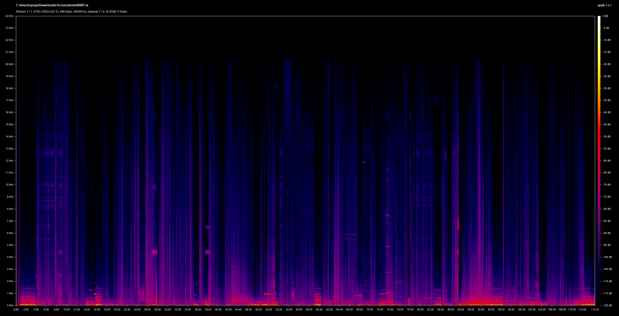 Earwig Dolby Digital 2.0 French Spek